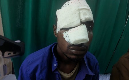 GICUMBI: Bari gutemwa n’Abarembetsi bakekwaho gutanga amakuru.