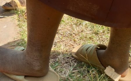 Gatsibo: Ubukene bugiye kwicisha abanyeshuri umwanda.